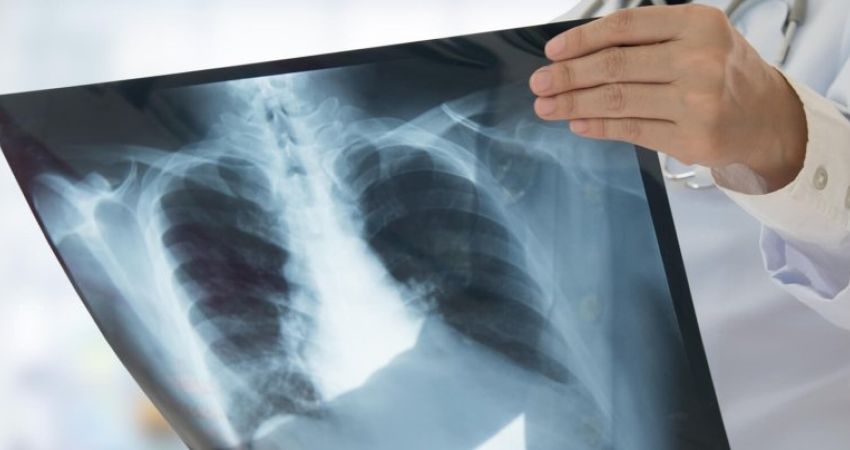 Radioprotezione, pubblicate le raccomandazioni emerse dal progetto europeo MEDIRAD