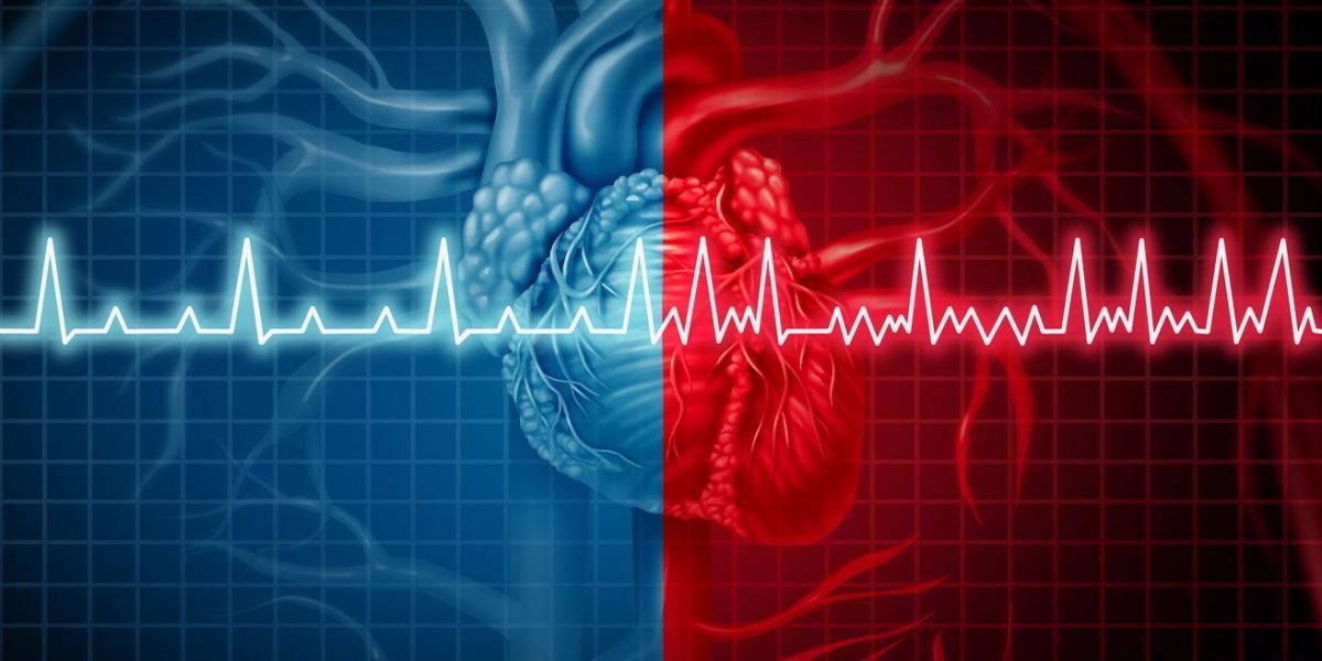 Orizzonti Aritmologici a “Cateteri Zero”