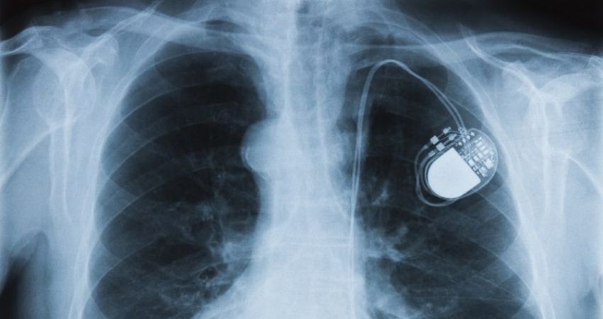 Registro italiano pacemaker e defibrillatori: dati 2015