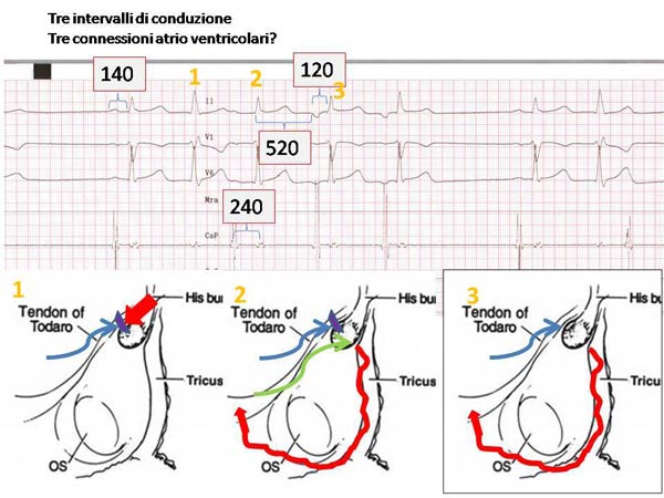 ecg forum: la sequenza