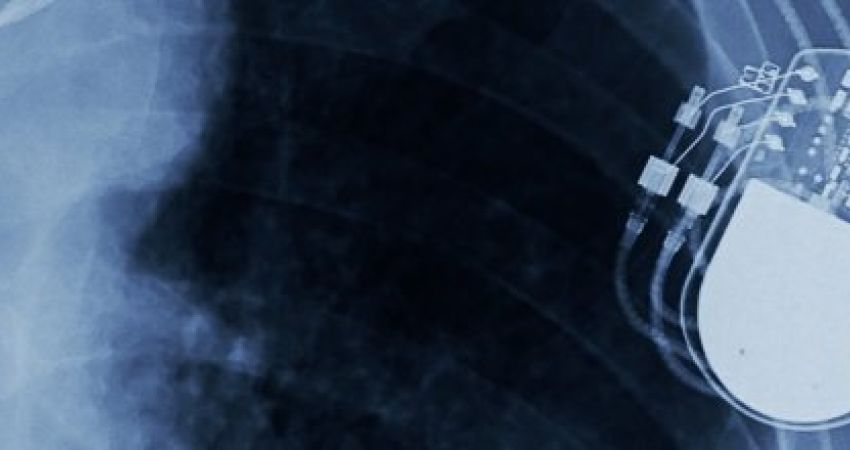 Corso per infermieri e tecnici: modulo PACEMAKER