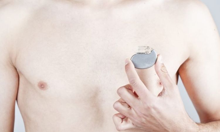 La vita del paziente con pacemaker o defibrillatore cardiaco (ICD)
