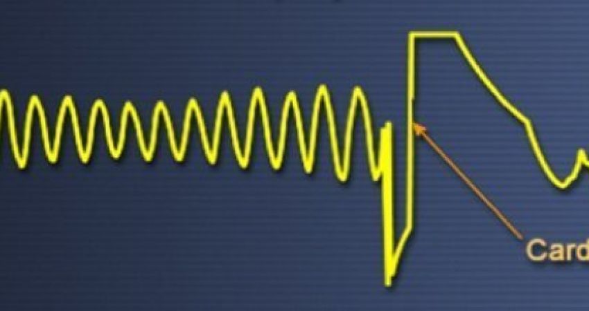 Corso per infermieri e tecnici: modulo DEFIBRILLATORI